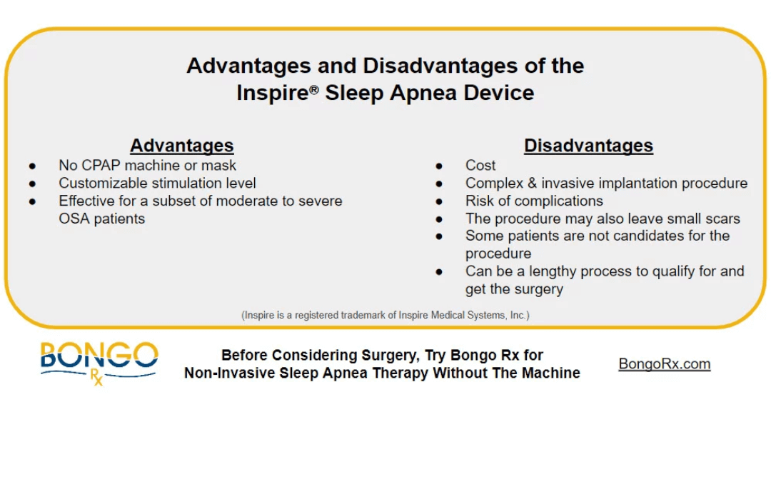 Inspire Sleep Apnea Device Treatment Overview Bongo Rx